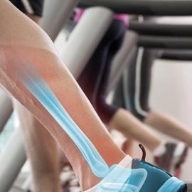 STAXCryo | Getting Fit Just Got Cooler | Charlotte, NC